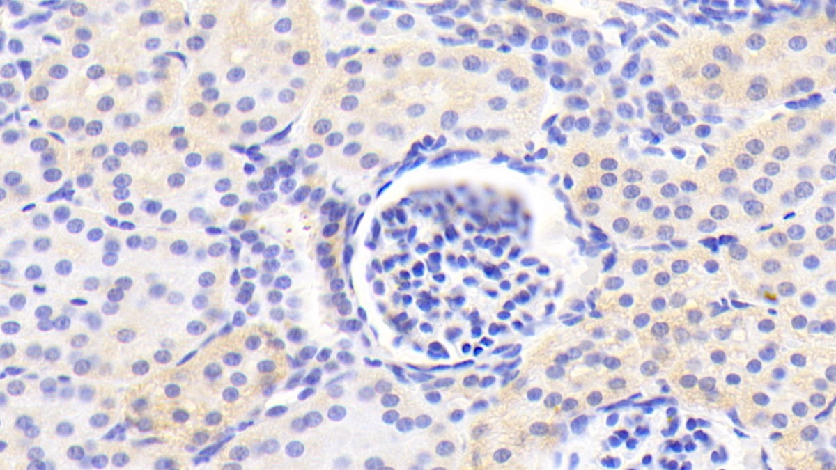 Polyclonal Antibody to Mannose Phosphate Isomerase (MPI)