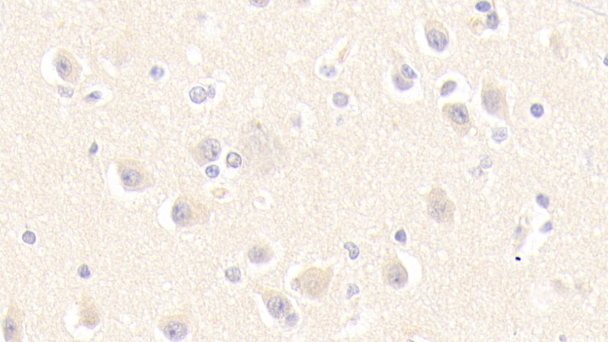 Polyclonal Antibody to Mannose Phosphate Isomerase (MPI)