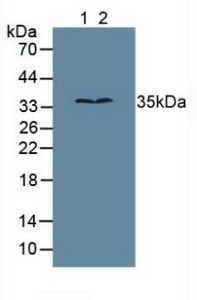 Polyclonal Antibody to N-Methylpurine DNA Glycosylase (MPG)