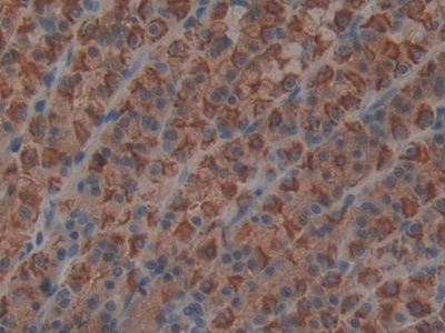 Polyclonal Antibody to Melanoma Inhibitory Activity Protein 1 (MIA1)