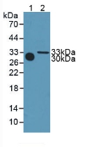 Polyclonal Antibody to Meteorin (METRN)