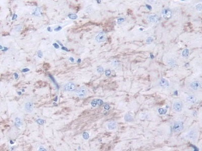 Polyclonal Antibody to Meteorin (METRN)