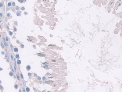 Polyclonal Antibody to Meteorin (METRN)