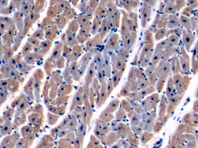 Polyclonal Antibody to Malate Dehydrogenase 2 (MDH2)