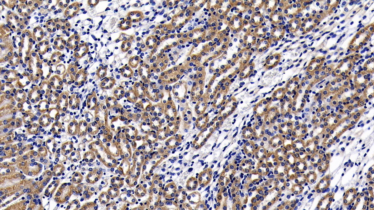 Polyclonal Antibody to Lymphocyte Antigen 96 (LY96)