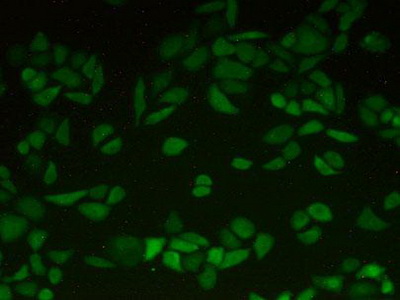 Polyclonal Antibody to Latexin (LXN)