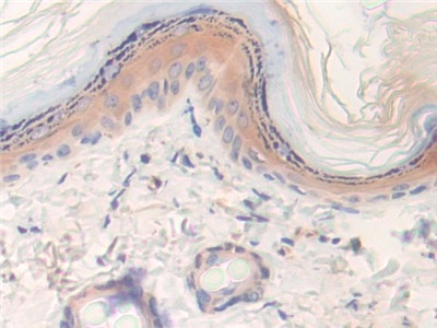 Polyclonal Antibody to Latexin (LXN)