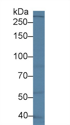 Polyclonal Antibody to Leucine Rich Repeat Kinase 2 (LRRK2)