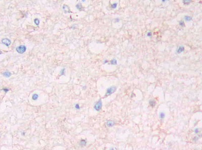 Polyclonal Antibody to Leucine Rich Repeat Kinase 2 (LRRK2)