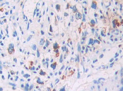 Polyclonal Antibody to Leucine Rich Repeat Kinase 2 (LRRK2)