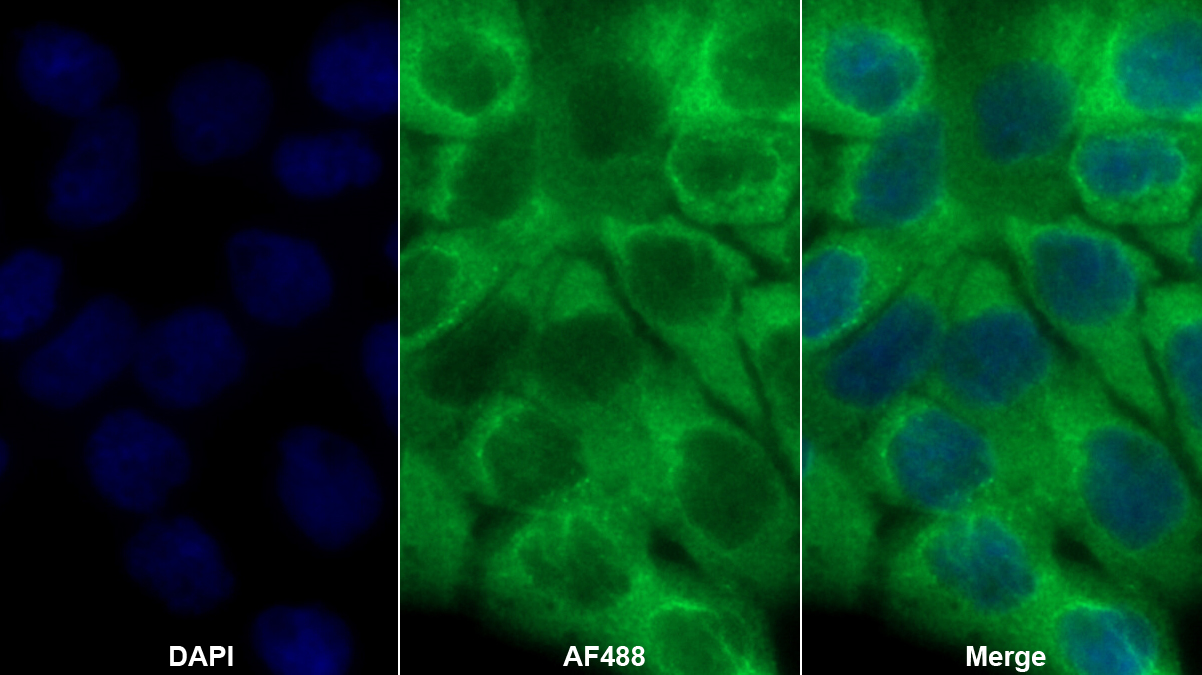 Polyclonal Antibody to Leucine Rich Repeat In FLII Interacting Protein 1 (LRRFIP1)