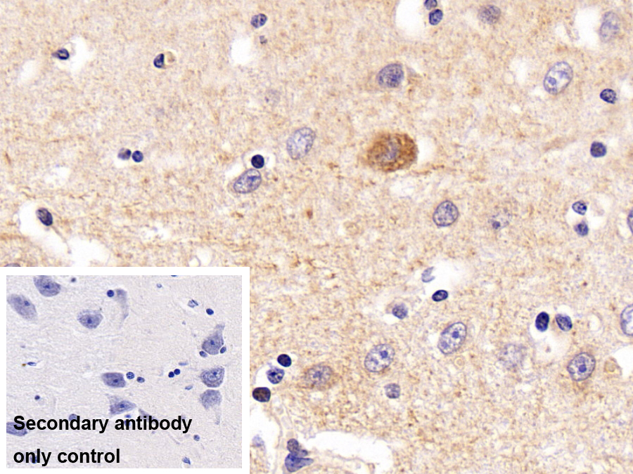 Polyclonal Antibody to Leucine Rich Repeat In FLII Interacting Protein 1 (LRRFIP1)