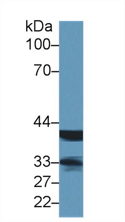 Polyclonal Antibody to Lectin, Mannose Binding 2 (LMAN2)