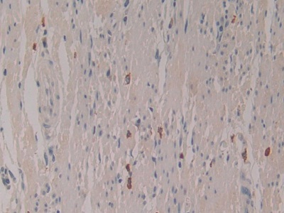 Polyclonal Antibody to Liver Expressed Antimicrobial Peptide 2 (LEAP2)