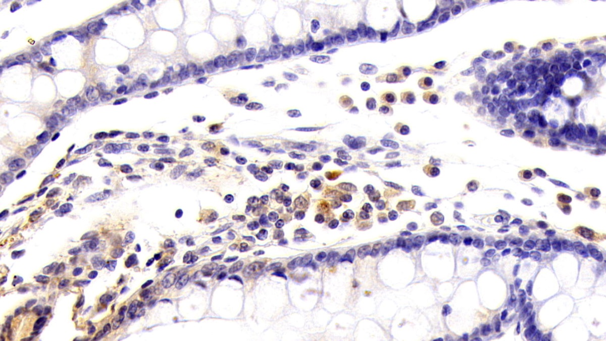 Polyclonal Antibody to Kynurenine-3-Monooxygenase (KMO)