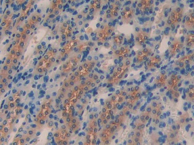 Polyclonal Antibody to Klotho Beta (KLb)