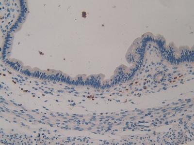 Polyclonal Antibody to Klotho (KL)