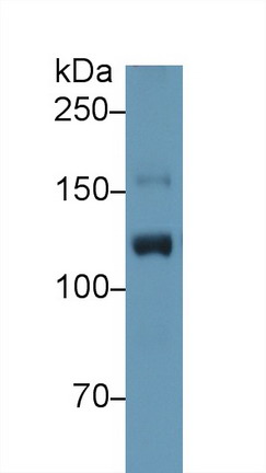 Polyclonal Antibody to Inter Alpha-Globulin Inhibitor H4 (ITIH4)