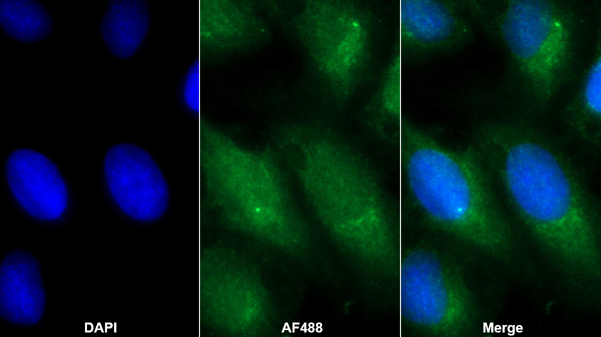 Polyclonal Antibody to Inter Alpha-Globulin Inhibitor H4 (ITIH4)