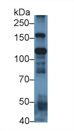 Polyclonal Antibody to Inter Alpha-Globulin Inhibitor H4 (ITIH4)