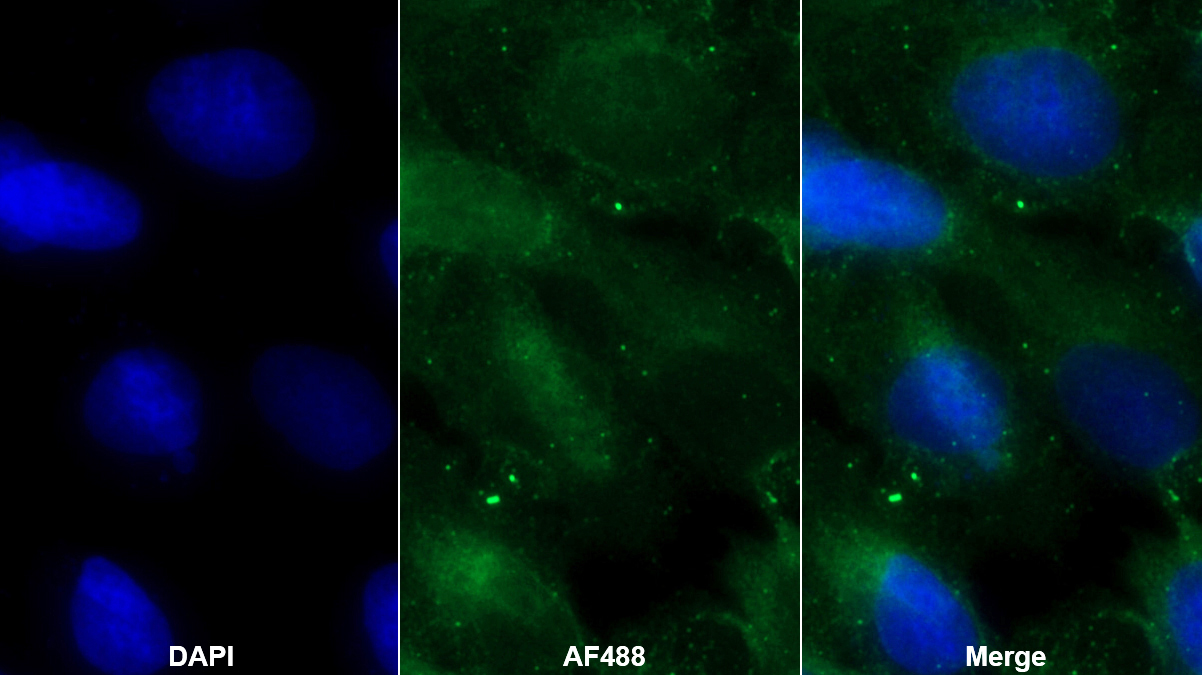 Polyclonal Antibody to Inter Alpha-Globulin Inhibitor H4 (ITIH4)