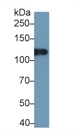 Polyclonal Antibody to Inter Alpha-Globulin Inhibitor H4 (ITIH4)