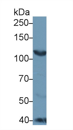 Polyclonal Antibody to Inter Alpha-Globulin Inhibitor H4 (ITIH4)