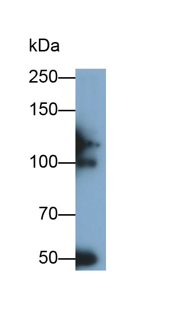 Polyclonal Antibody to Inter Alpha-Globulin Inhibitor H4 (ITIH4)