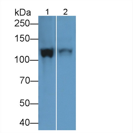 Polyclonal Antibody to Inter Alpha-Globulin Inhibitor H4 (ITIH4)