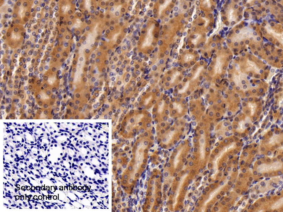 Polyclonal Antibody to Inter Alpha-Globulin Inhibitor H4 (ITIH4)