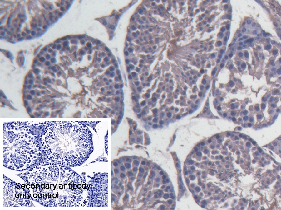 Polyclonal Antibody to Inter Alpha-Globulin Inhibitor H4 (ITIH4)