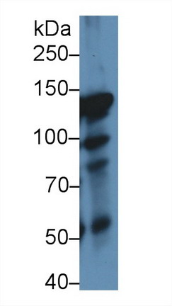 Polyclonal Antibody to Inter Alpha-Globulin Inhibitor H4 (ITIH4)