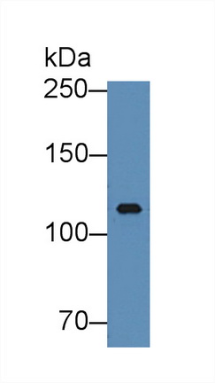 Polyclonal Antibody to Inter Alpha-Globulin Inhibitor H3 (ITIH3)