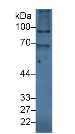 Polyclonal Antibody to Inter Alpha-Globulin Inhibitor H2 (ITIH2)