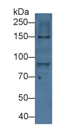 Polyclonal Antibody to Inter Alpha-Globulin Inhibitor H2 (ITIH2)