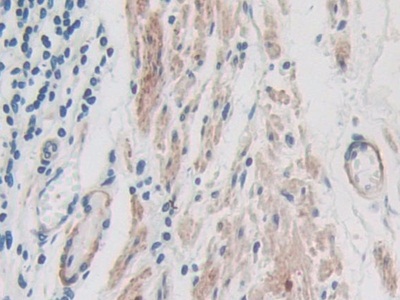 Polyclonal Antibody to Inter Alpha-Globulin Inhibitor H1 (ITIH1)