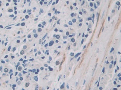 Polyclonal Antibody to Inter Alpha-Globulin Inhibitor H1 (ITIH1)