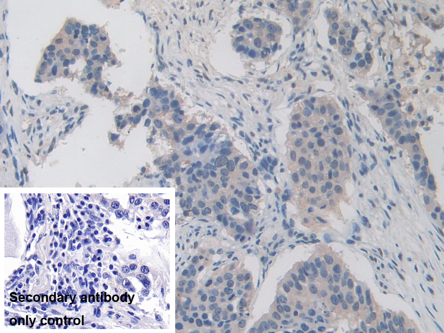 Polyclonal Antibody to Inter Alpha-Globulin Inhibitor H1 (ITIH1)