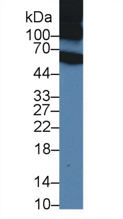 Polyclonal Antibody to Inter Alpha-Globulin Inhibitor H1 (ITIH1)