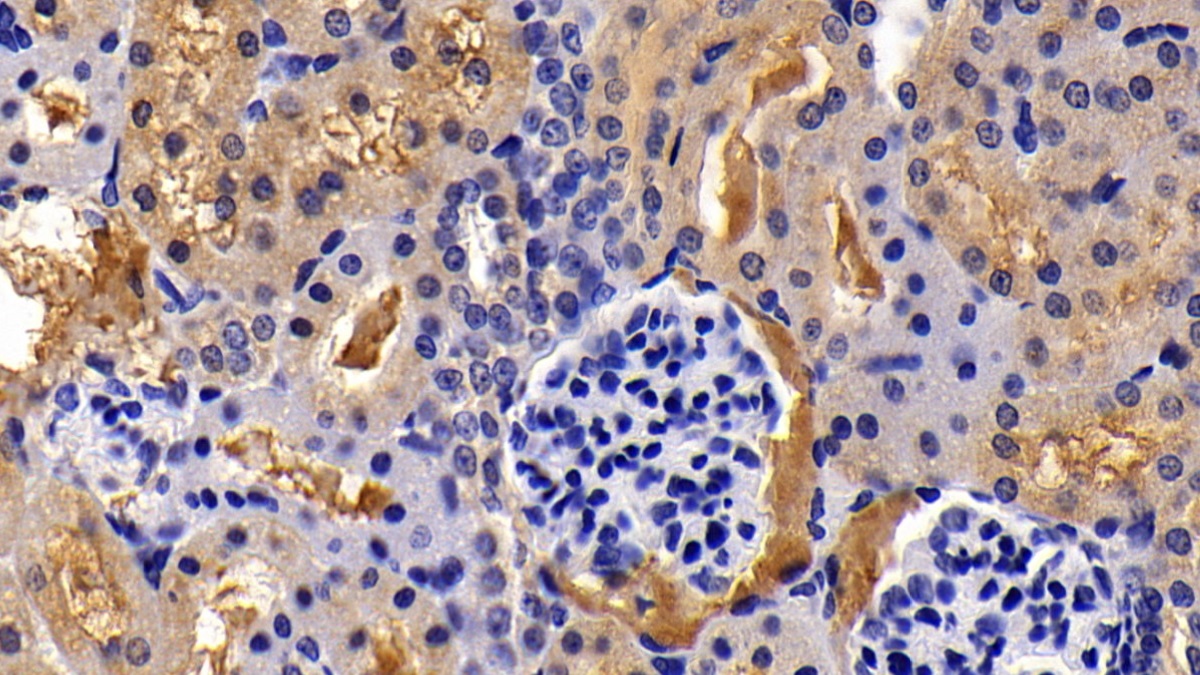 Polyclonal Antibody to Immunoglobulin Superfamily Containing Leucine Rich Repeat Protein (ISLR)