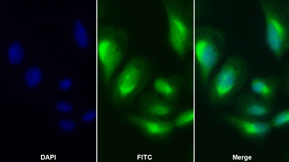 Polyclonal Antibody to Immunoglobulin Superfamily Containing Leucine Rich Repeat Protein (ISLR)