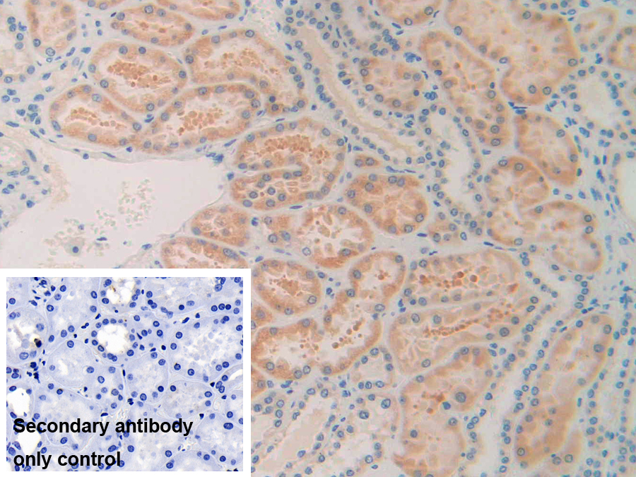 Polyclonal Antibody to Immunoglobulin Superfamily Containing Leucine Rich Repeat Protein (ISLR)