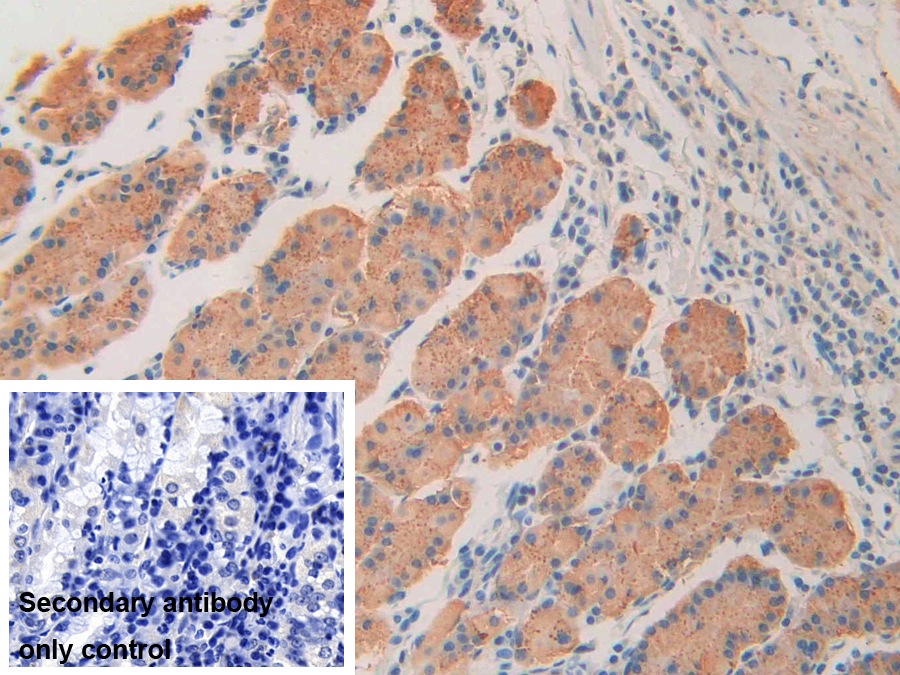 Polyclonal Antibody to Immunoglobulin Superfamily Containing Leucine Rich Repeat Protein (ISLR)