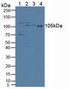 Polyclonal Antibody to Iron Responsive Element Binding Protein 2 (IREB2)