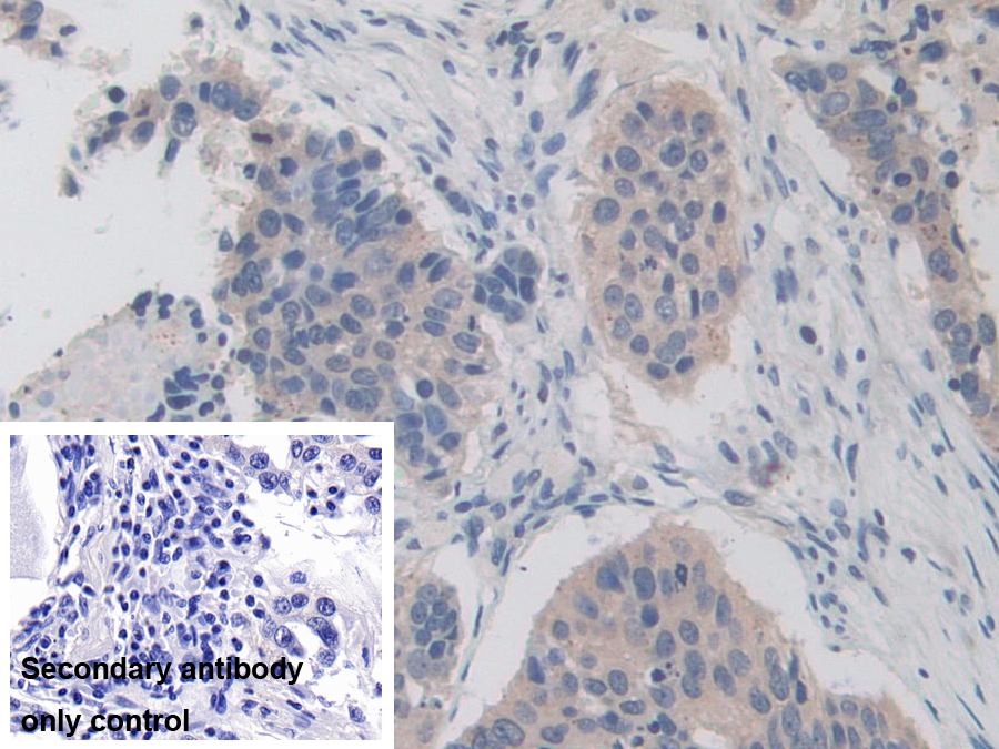 Polyclonal Antibody to Iron Responsive Element Binding Protein 2 (IREB2)