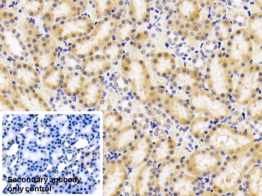 Polyclonal Antibody to Iron Responsive Element Binding Protein 2 (IREB2)