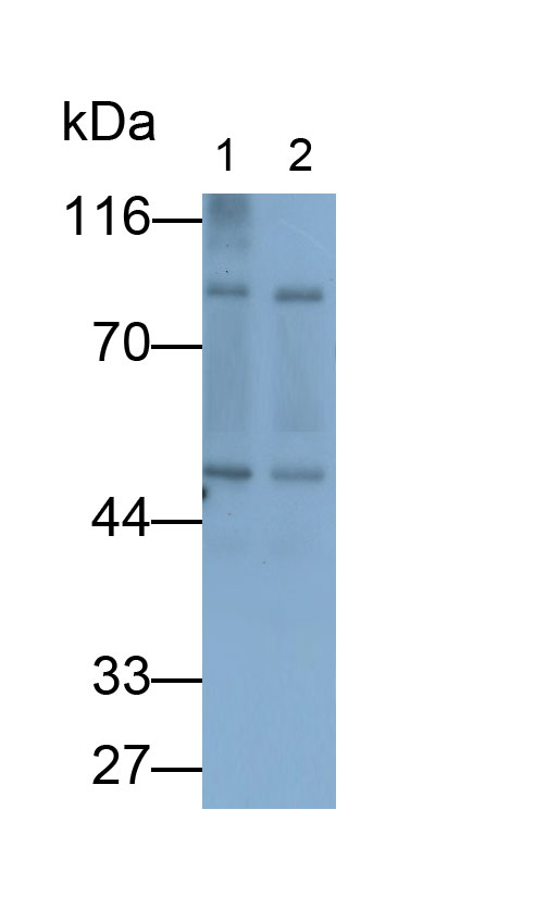 Polyclonal Antibody to Interleukin 1 Receptor Accessory Protein Like Protein 1 (IL1RAPL1)