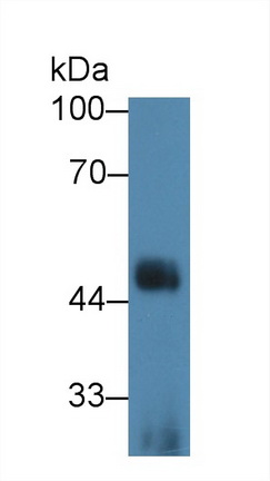 Polyclonal Antibody to Interleukin 1 Receptor Like Protein 1 (IL1RL1)