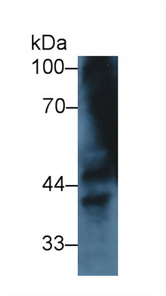 Polyclonal Antibody to Interleukin 1 Receptor Like Protein 1 (IL1RL1)