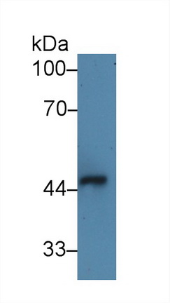 Polyclonal Antibody to Interleukin 1 Receptor Like Protein 1 (IL1RL1)